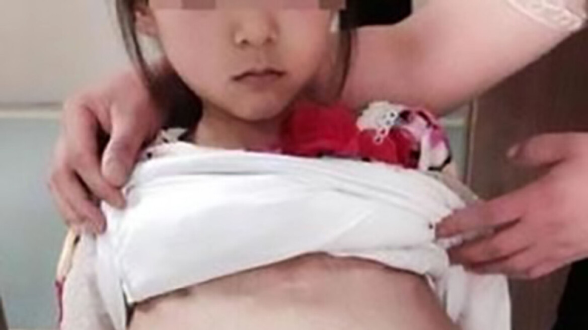 Κίνα: 40χρονος πήγε 12χρονη έγκυο στο νοσοκομείο λέγοντας πως είναι η 20χρονη σύζυγός του